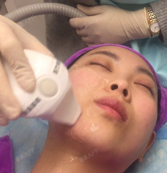 最新溶脂技術(shù)重塑自信人生旅程