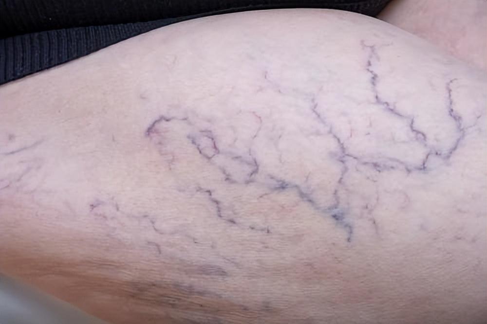 深度探討疾病現(xiàn)狀，最新病情與應(yīng)對策略解析